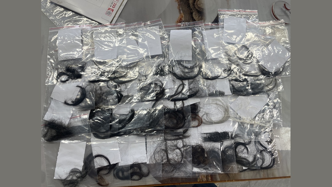 头发样品待测硒评估人体硒营养水平